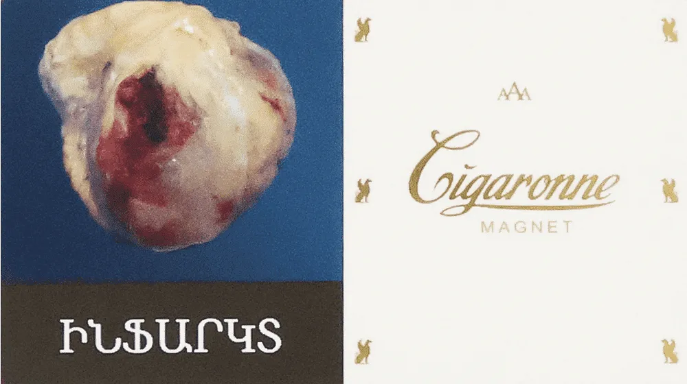 Tobacco "Cigaronne Magnet"
